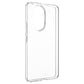FIXED Story TPU Back Cover for Honor 200 5G, clear
