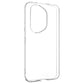 FIXED Story TPU Back Cover for Honor 400 Pro, clear