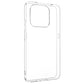 FIXED Story TPU Back Cover for Honor 400 Smart 5G, clear